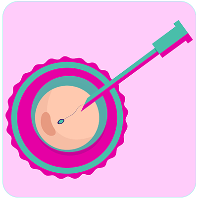 Infertility treatment